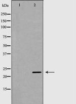 NGAL Antibody in Western Blot (WB)