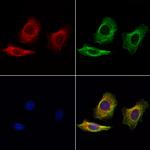 LIF Antibody in Immunocytochemistry (ICC/IF)