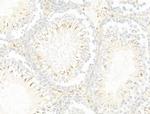 LIF Antibody in Immunohistochemistry (Paraffin) (IHC (P))