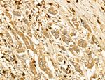 LIFR Antibody in Immunohistochemistry (Paraffin) (IHC (P))