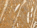 LIFR Antibody in Immunohistochemistry (Paraffin) (IHC (P))