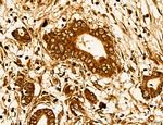 LIFR Antibody in Immunohistochemistry (Paraffin) (IHC (P))