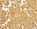 LIFR Antibody in Immunohistochemistry (Paraffin) (IHC (P))