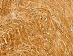 LIFR Antibody in Immunohistochemistry (Paraffin) (IHC (P))