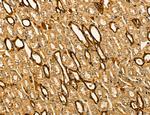 LIFR Antibody in Immunohistochemistry (Paraffin) (IHC (P))