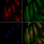 LIS1 Antibody in Immunocytochemistry (ICC/IF)