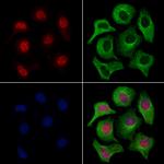 LMX1A Antibody in Immunocytochemistry (ICC/IF)