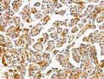 LMX1A Antibody in Immunohistochemistry (Paraffin) (IHC (P))