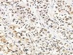 LMX1A Antibody in Immunohistochemistry (Paraffin) (IHC (P))