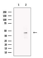 LMX1A Antibody in Western Blot (WB)