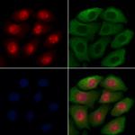 LOXL2 Antibody in Immunocytochemistry (ICC/IF)