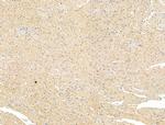 LOXL2 Antibody in Immunohistochemistry (Paraffin) (IHC (P))