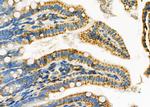 LRP1B Antibody in Immunohistochemistry (Paraffin) (IHC (P))