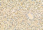 LRP1B Antibody in Immunohistochemistry (Paraffin) (IHC (P))