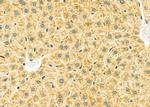 LRP1B Antibody in Immunohistochemistry (Paraffin) (IHC (P))