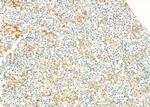 LRP1B Antibody in Immunohistochemistry (Paraffin) (IHC (P))