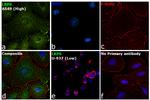 LRP6 Antibody