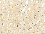 MACC1 Antibody in Immunohistochemistry (Paraffin) (IHC (P))