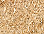 MACC1 Antibody in Immunohistochemistry (Paraffin) (IHC (P))