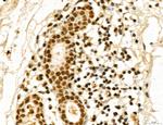 MACC1 Antibody in Immunohistochemistry (Paraffin) (IHC (P))