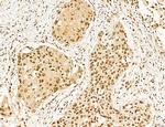 MACC1 Antibody in Immunohistochemistry (Paraffin) (IHC (P))