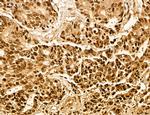 MACC1 Antibody in Immunohistochemistry (Paraffin) (IHC (P))