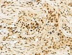 MACC1 Antibody in Immunohistochemistry (Paraffin) (IHC (P))