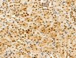 MACC1 Antibody in Immunohistochemistry (Paraffin) (IHC (P))