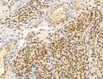 MACC1 Antibody in Immunohistochemistry (Paraffin) (IHC (P))