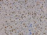 H2AFY2 Antibody in Immunohistochemistry (Paraffin) (IHC (P))