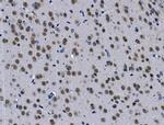 H2AFY2 Antibody in Immunohistochemistry (Paraffin) (IHC (P))