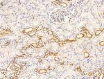 H2AFY2 Antibody in Immunohistochemistry (Paraffin) (IHC (P))