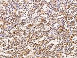 H2AFY2 Antibody in Immunohistochemistry (Paraffin) (IHC (P))