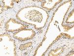 H2AFY2 Antibody in Immunohistochemistry (Paraffin) (IHC (P))