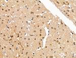 H2AFY2 Antibody in Immunohistochemistry (Paraffin) (IHC (P))