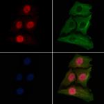 Histone Macro-H2A.1 Antibody in Immunocytochemistry (ICC/IF)