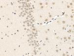 MAML2 Antibody in Immunohistochemistry (Paraffin) (IHC (P))