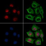 MAPKAPK3 Antibody in Immunocytochemistry (ICC/IF)