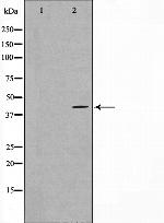 MAPKAPK3 Antibody in Western Blot (WB)