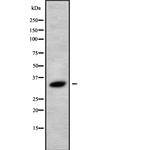 MARCH8 Antibody in Western Blot (WB)