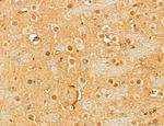 MAT2A Antibody in Immunohistochemistry (Paraffin) (IHC (P))