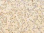 MAT2A Antibody in Immunohistochemistry (Paraffin) (IHC (P))