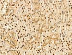 MAT2A Antibody in Immunohistochemistry (Paraffin) (IHC (P))