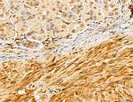 MAT2A Antibody in Immunohistochemistry (Paraffin) (IHC (P))