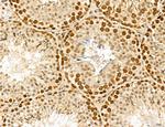 MAT2A Antibody in Immunohistochemistry (Paraffin) (IHC (P))