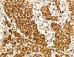 MAT2A Antibody in Immunohistochemistry (Paraffin) (IHC (P))