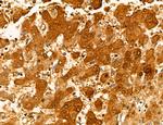 MAT2A Antibody in Immunohistochemistry (Paraffin) (IHC (P))