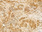 MAT2A Antibody in Immunohistochemistry (Paraffin) (IHC (P))