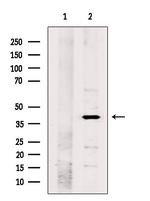 MBD2 Antibody in Western Blot (WB)