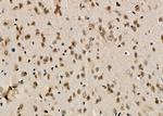 MCM7 Antibody in Immunohistochemistry (Paraffin) (IHC (P))